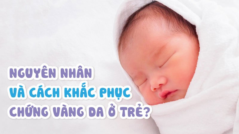 vàng da trẻ nhỏ