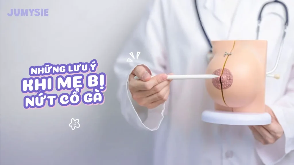 những lưu ý khi mẹ bị nứt cổ gà